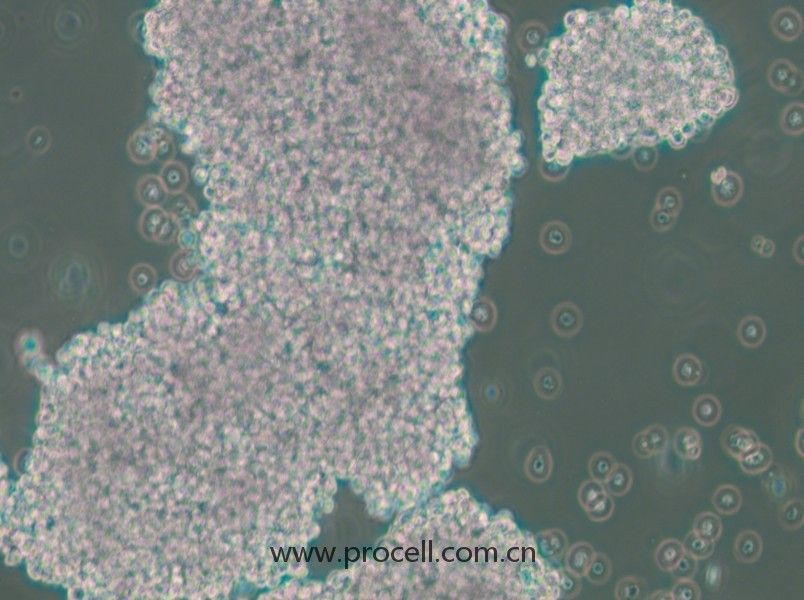 NCI-H1417（人小細(xì)胞肺癌細(xì)胞）（STR鑒定正確）