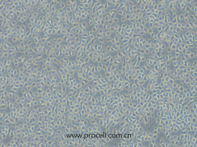 JM-1（人B淋巴母細(xì)胞瘤細(xì)胞）（STR鑒定正確）