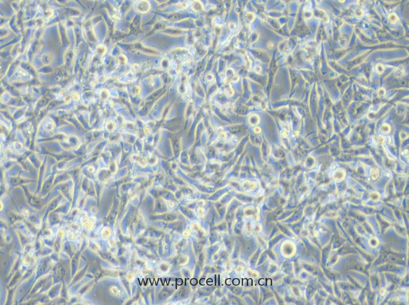EBC-1 (人肺癌鱗癌細(xì)胞) (STR鑒定正確)