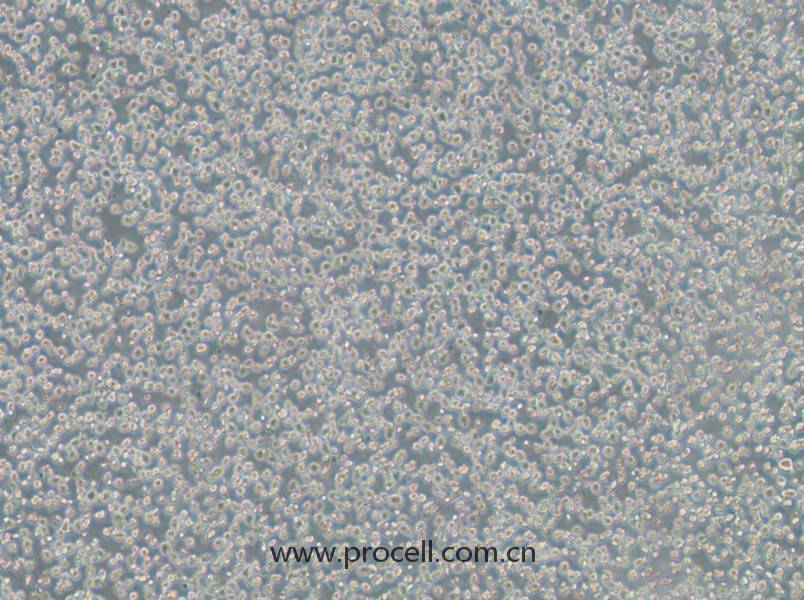 OPM2(人骨髓瘤細胞)(STR鑒定正確)