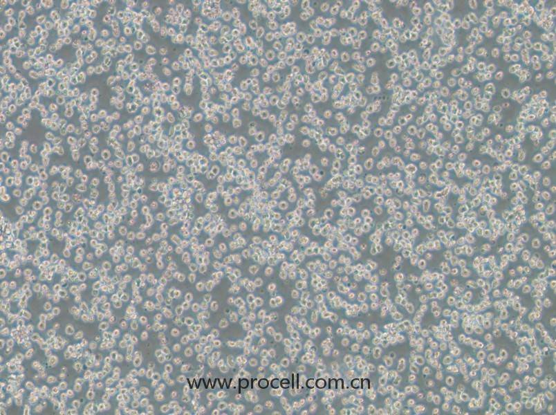 OPM2(人骨髓瘤細(xì)胞)(STR鑒定正確)