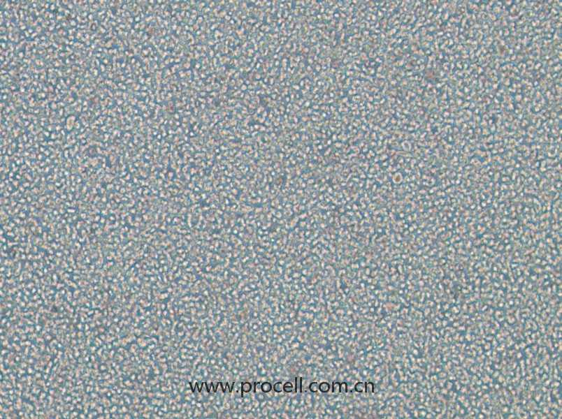 OPM2(人骨髓瘤細(xì)胞)(STR鑒定正確)