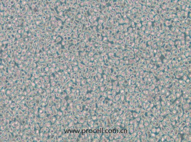 OPM2(人骨髓瘤細(xì)胞)(STR鑒定正確)