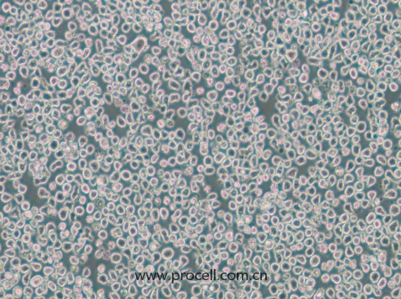 OPM2(人骨髓瘤細(xì)胞)(STR鑒定正確)