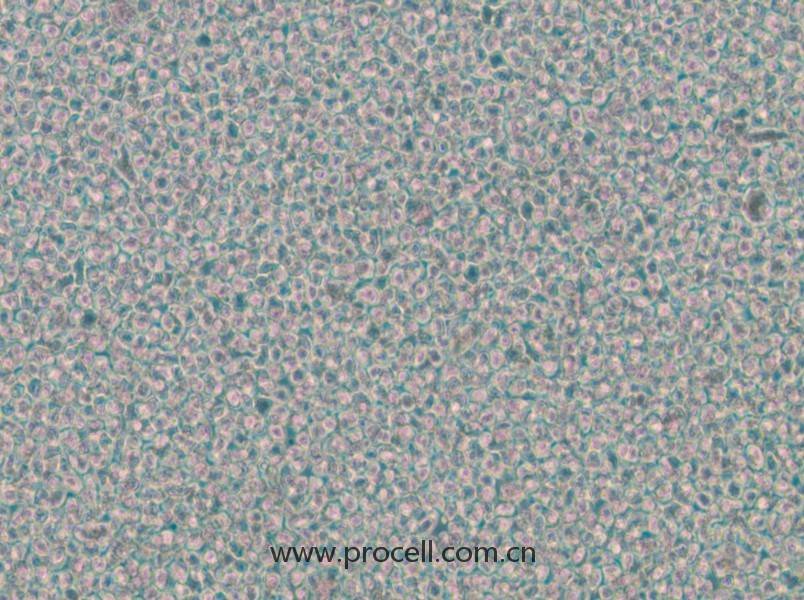 OPM2(人骨髓瘤細(xì)胞)(STR鑒定正確)