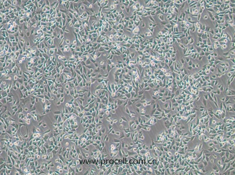 CHP-212(人腦神經(jīng)母細胞)(STR鑒定正確)