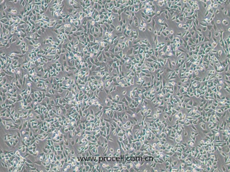 CHP-212(人腦神經(jīng)母細胞)(STR鑒定正確)