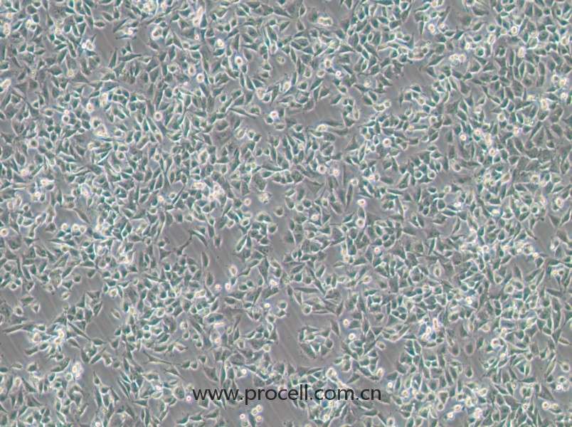 CHP-212(人腦神經(jīng)母細胞)(STR鑒定正確)