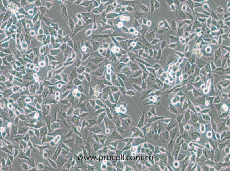 CHP-212(人腦神經(jīng)母細胞)(STR鑒定正確)