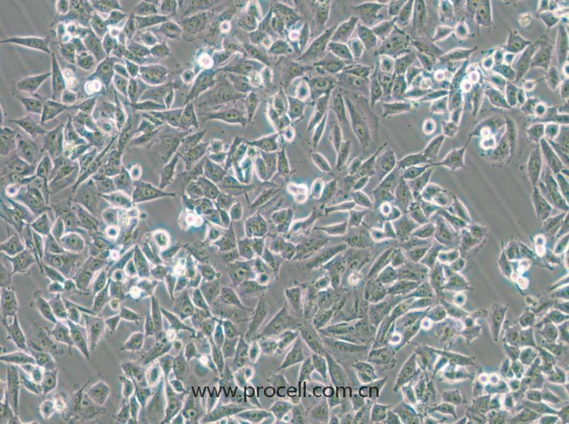 CHP-212(人腦神經(jīng)母細胞)(STR鑒定正確)