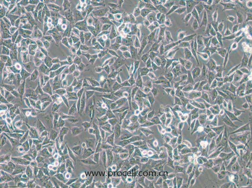 CHP-212(人腦神經(jīng)母細胞)(STR鑒定正確)