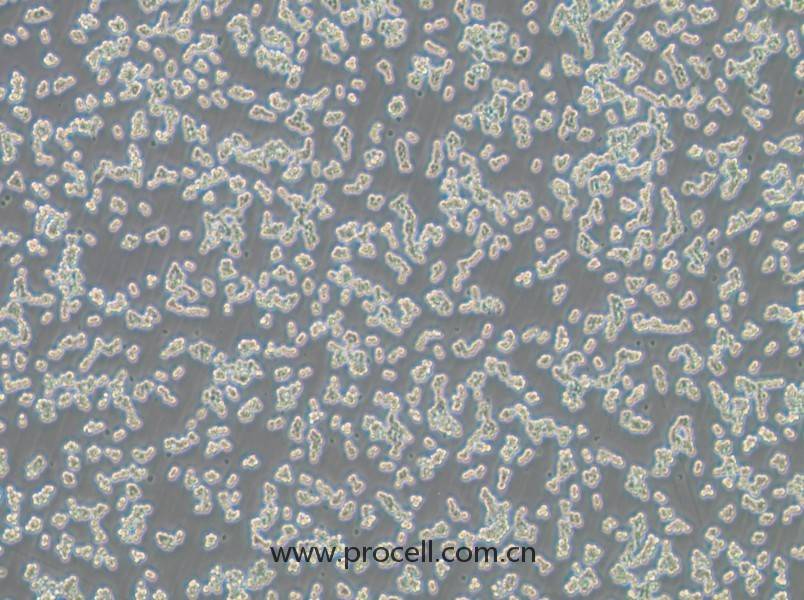 RAW 264.7-LUC (小鼠單核巨噬細(xì)胞白血病細(xì)胞（熒光素酶標(biāo)記）) (STR鑒定正確)