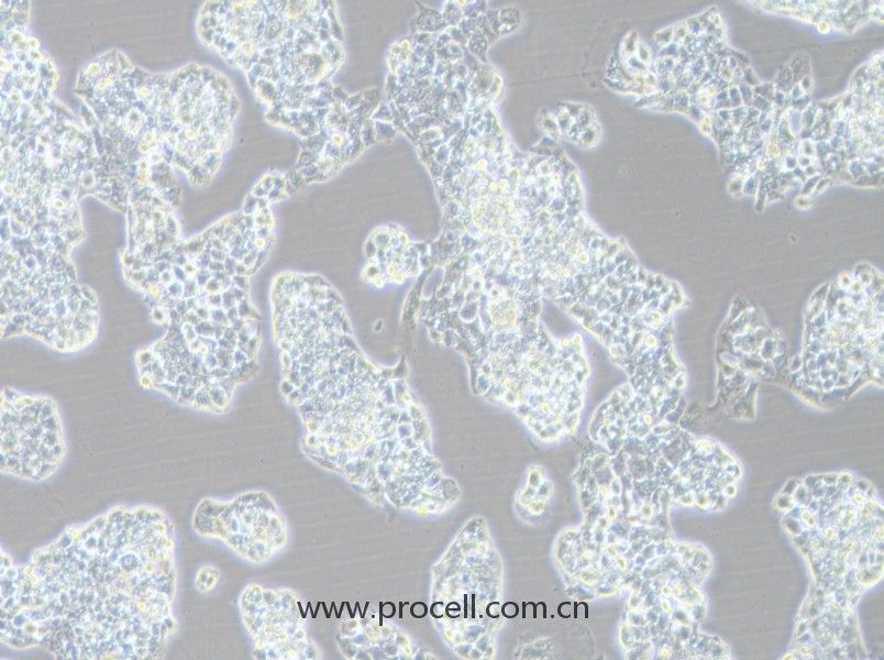 Hep G2-LUC (	人肝癌細(xì)胞（熒光素酶標(biāo)記）) (STR鑒定正確)