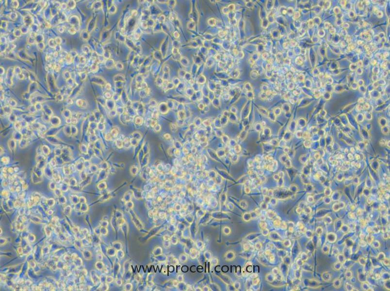 BV2-EGFP (小鼠小膠質(zhì)細胞(綠色熒光標記)) (STR鑒定正確)
