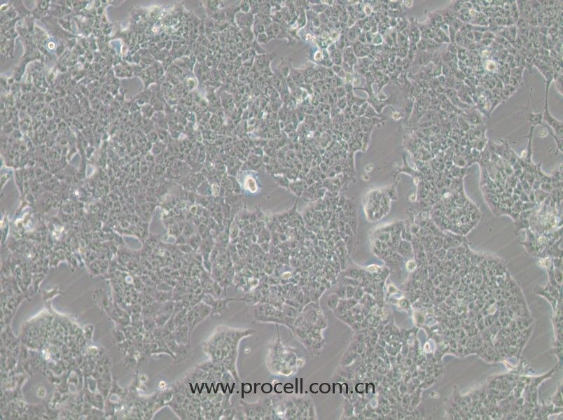 HePa1-6-GFP (小鼠肝癌細(xì)胞（綠色熒光標(biāo)記）) (STR鑒定正確)