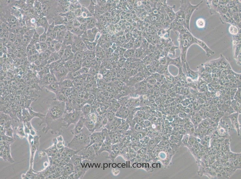 HePa1-6-GFP (小鼠肝癌細(xì)胞（綠色熒光標(biāo)記）) (STR鑒定正確)