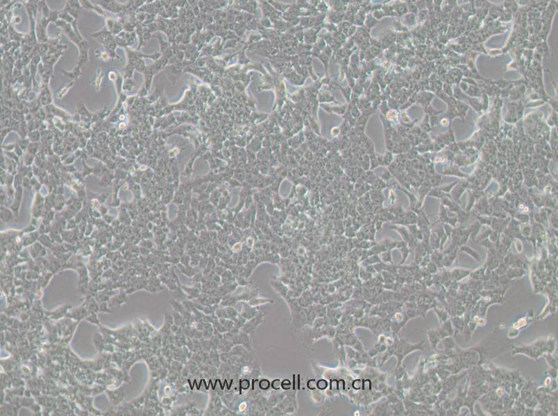 HePa1-6-LUC (小鼠肝癌細(xì)胞（熒光素酶標(biāo)記）) (STR鑒定正確)