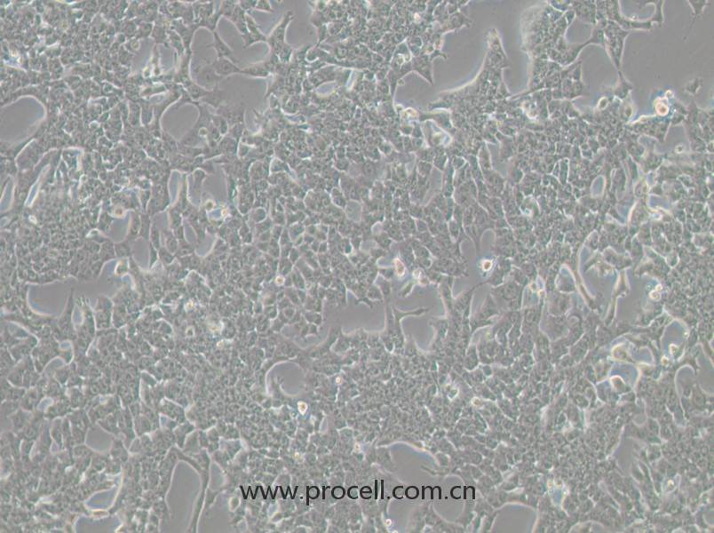 HePa1-6-LUC (小鼠肝癌細(xì)胞（熒光素酶標(biāo)記）) (STR鑒定正確)