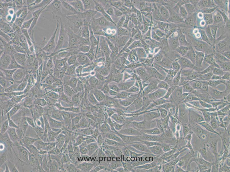 NIH/3T3-GFP（小鼠胚胎細(xì)胞（綠色熒光標(biāo)記））(STR鑒定正確)