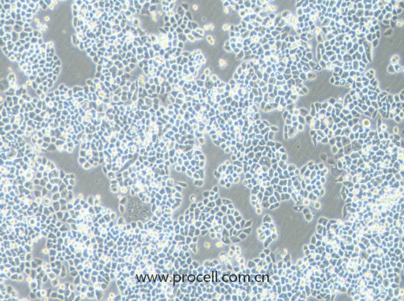HCT-15-5FU (人結(jié)直腸癌氟尿嘧啶耐藥株) (STR鑒定正確)