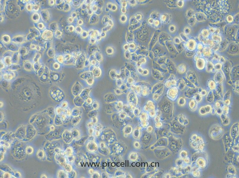 GCIY（人胃癌細(xì)胞）（STR鑒定正確）