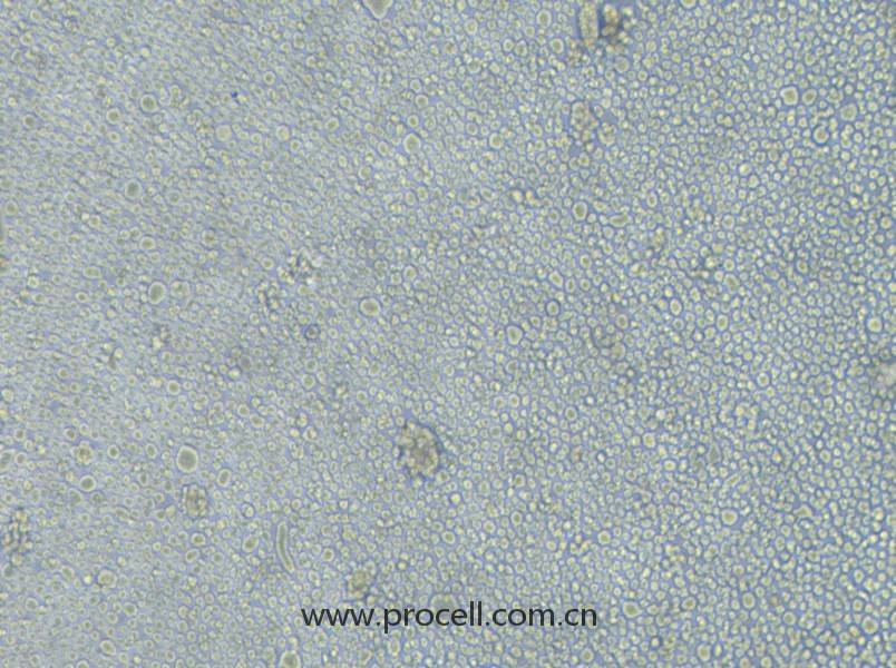 LP-1(人多發(fā)性骨髓瘤細(xì)胞)(STR鑒定正確)