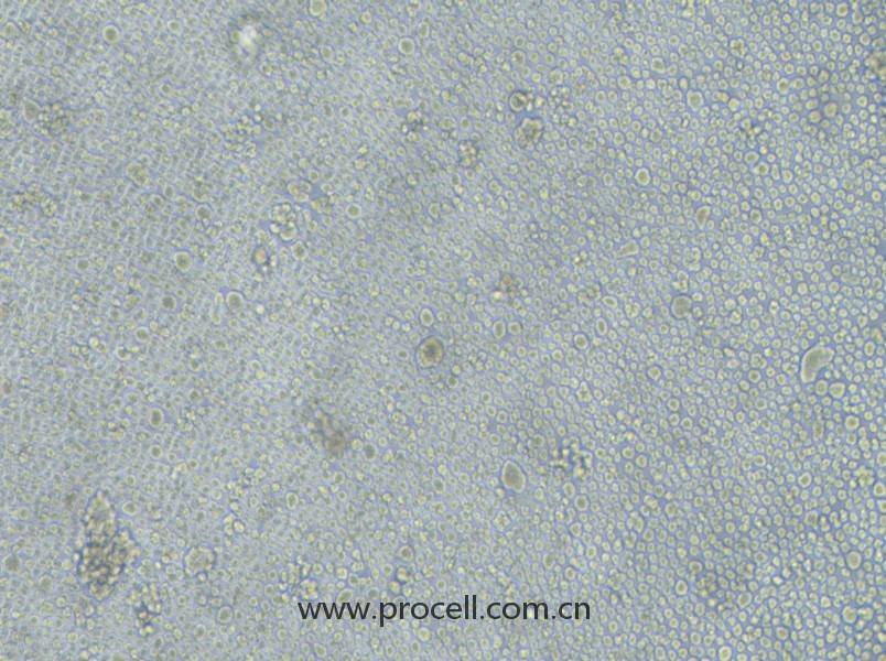 LP-1(人多發(fā)性骨髓瘤細(xì)胞)(STR鑒定正確)