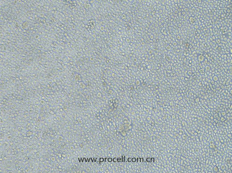 LP-1(人多發(fā)性骨髓瘤細(xì)胞)(STR鑒定正確)