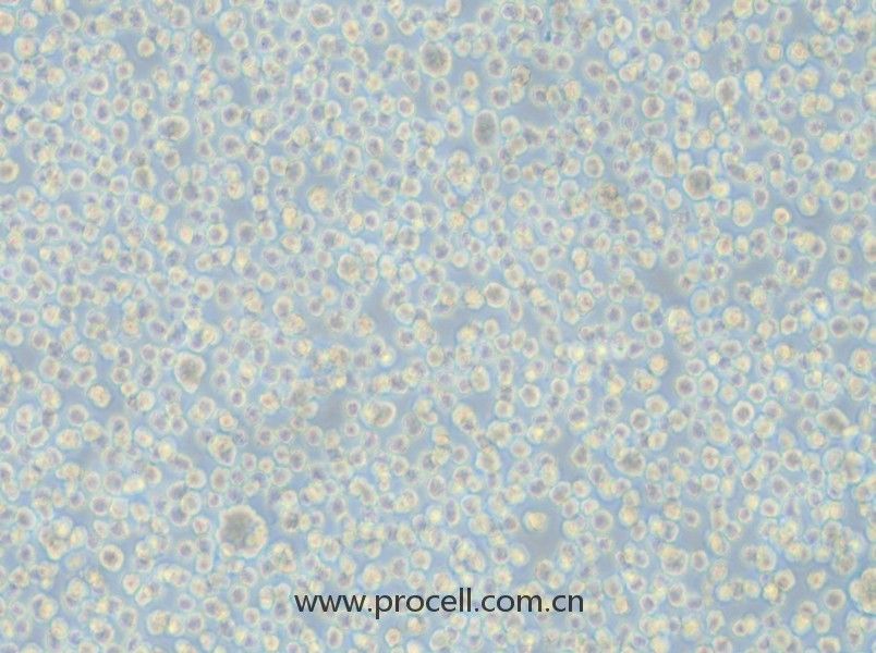 LP-1(人多發(fā)性骨髓瘤細(xì)胞)(STR鑒定正確)