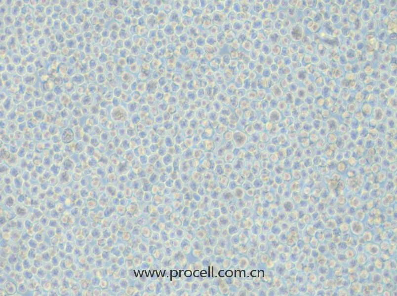 LP-1(人多發(fā)性骨髓瘤細(xì)胞)(STR鑒定正確)