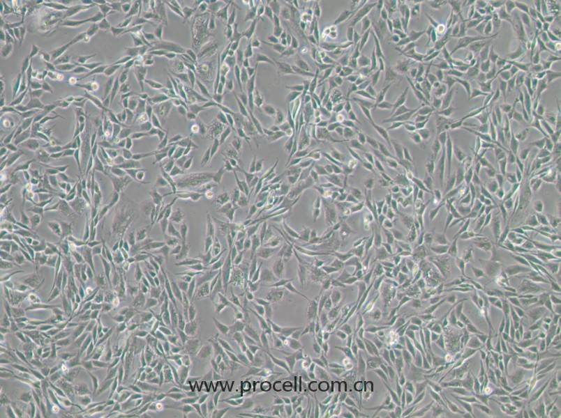 CCF-STTG1（人腦星形膠質(zhì)細(xì)胞瘤細(xì)胞）（STR鑒定正確）