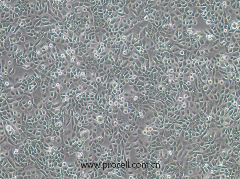 VK2/E6E7(人陰道上皮細(xì)胞)(STR鑒定正確)