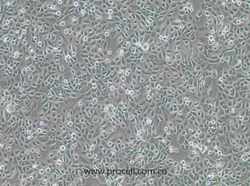VK2/E6E7(人陰道上皮細(xì)胞)(STR鑒定正確)