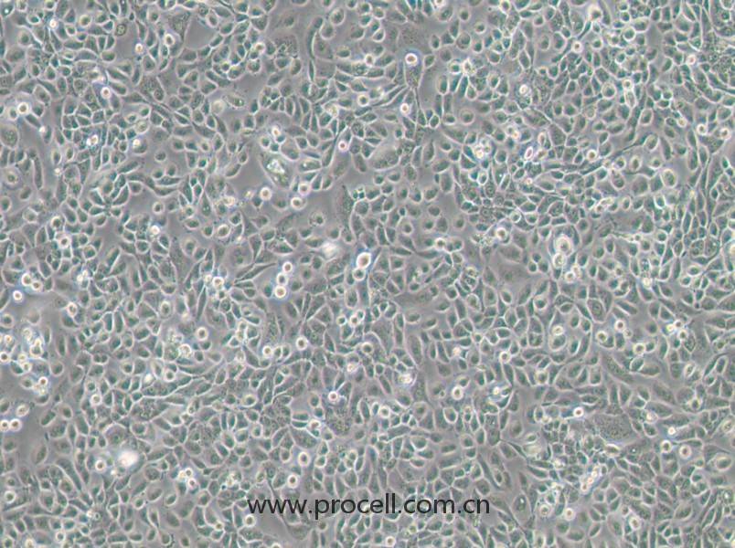 VK2/E6E7(人陰道上皮細(xì)胞)(STR鑒定正確)