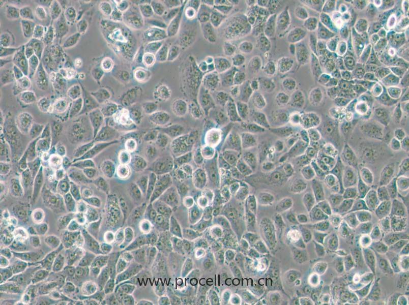 VK2/E6E7(人陰道上皮細(xì)胞)(STR鑒定正確)