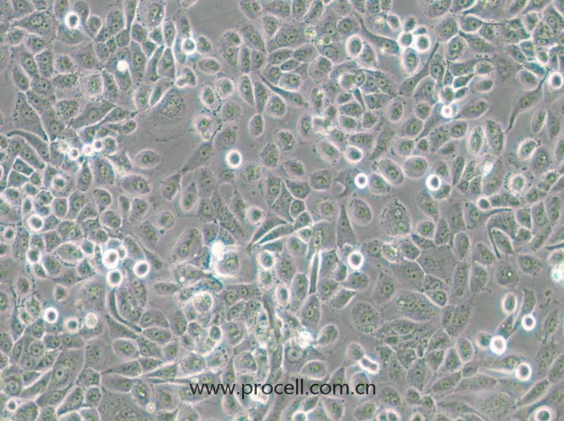 VK2/E6E7(人陰道上皮細(xì)胞)(STR鑒定正確)