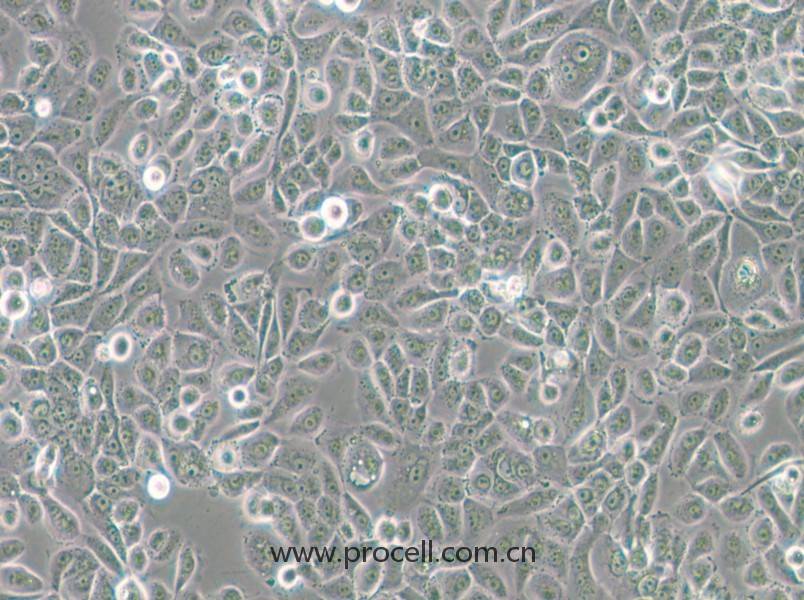 VK2/E6E7(人陰道上皮細(xì)胞)(STR鑒定正確)