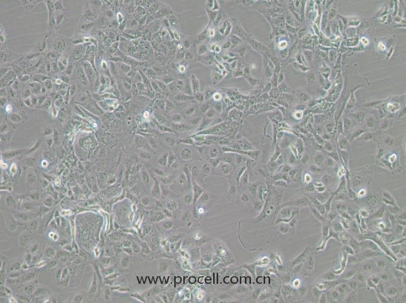 GLAG-66（人甲狀腺癌細(xì)胞）（STR鑒定）