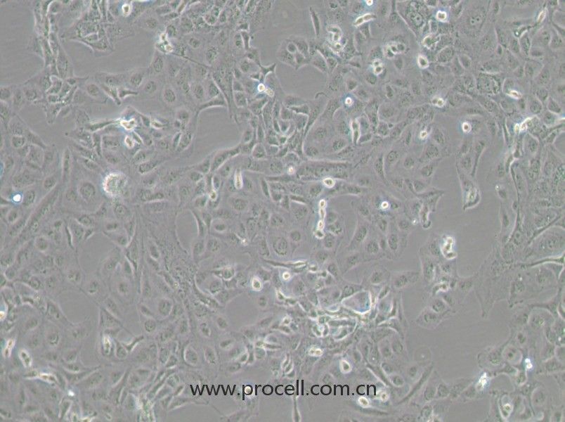 GLAG-66（人甲狀腺癌細(xì)胞）（STR鑒定）