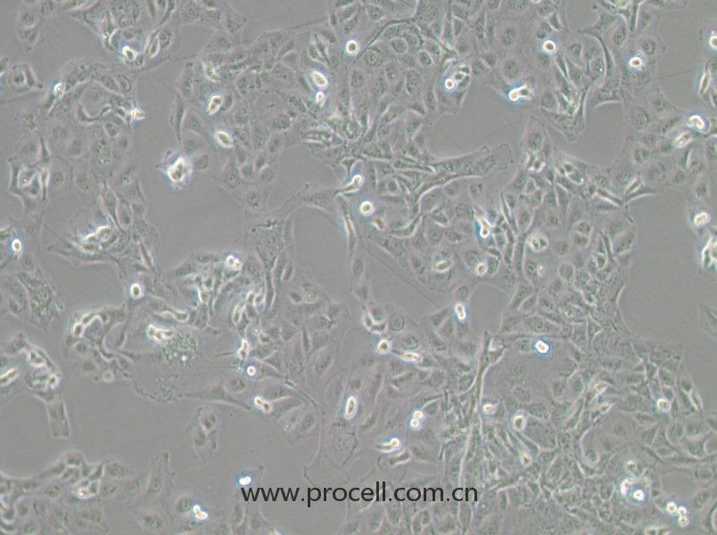GLAG-66（人甲狀腺癌細(xì)胞）（STR鑒定）