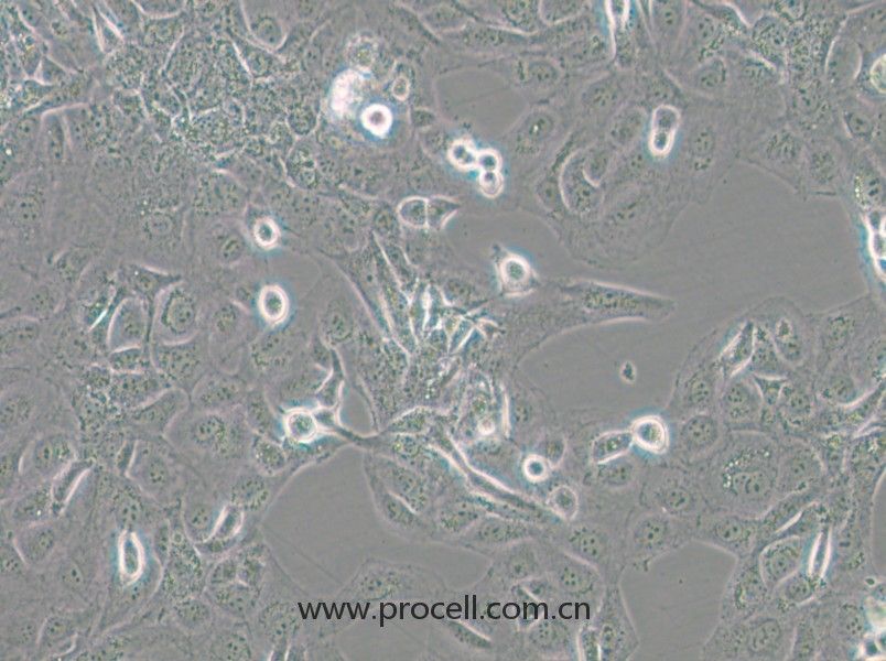 GLAG-66（人甲狀腺癌細(xì)胞）（STR鑒定）