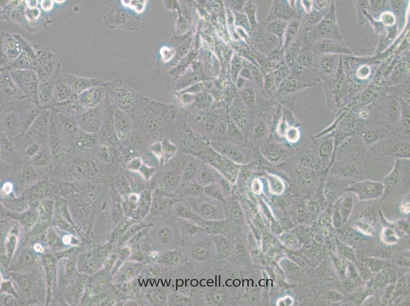 GLAG-66（人甲狀腺癌細(xì)胞）（STR鑒定）
