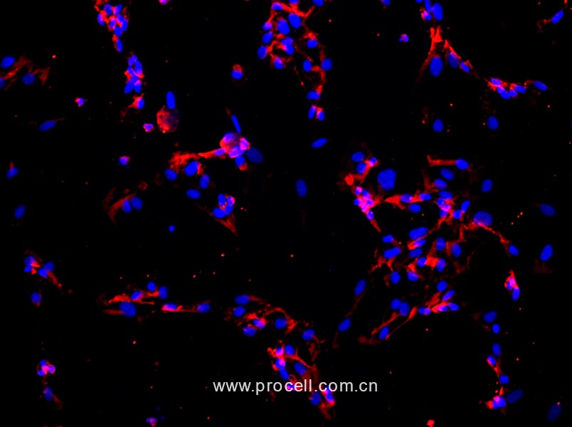 人肺大動脈內(nèi)皮細胞