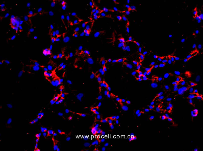 人臍動脈內(nèi)皮細(xì)胞
