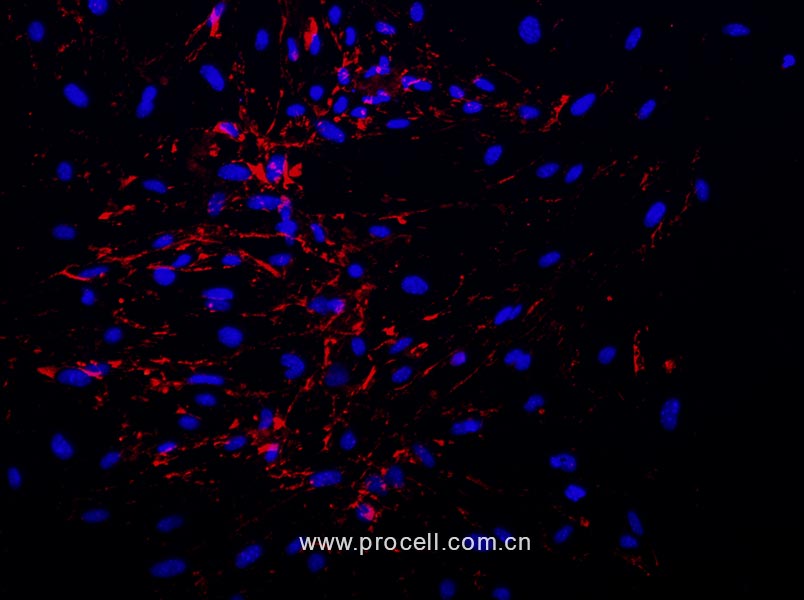 小鼠腦微血管內(nèi)皮細胞