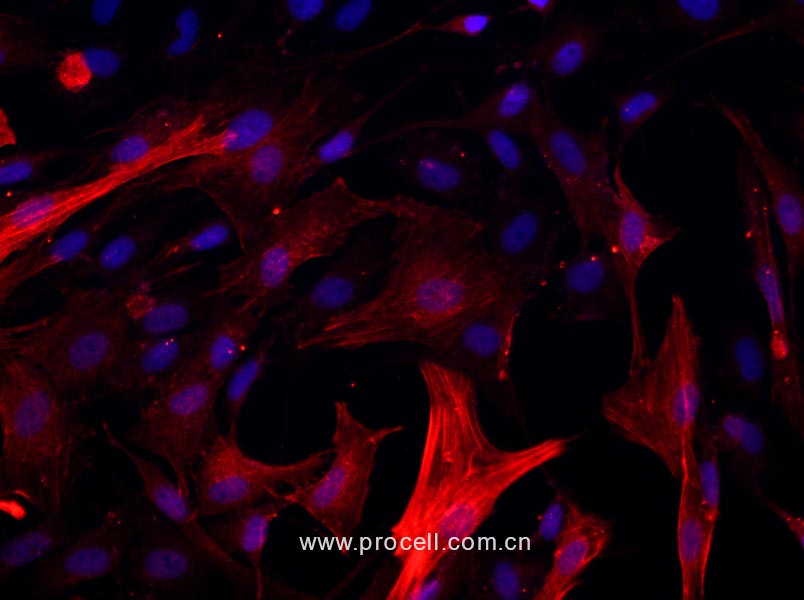大鼠氣管平滑肌細(xì)胞