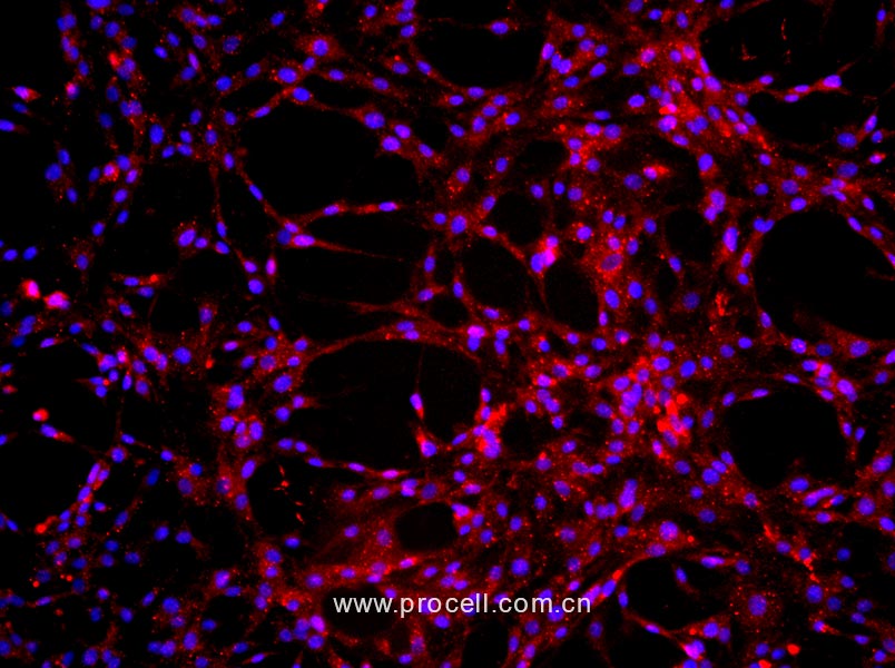 大鼠肺大動(dòng)脈內(nèi)皮細(xì)胞