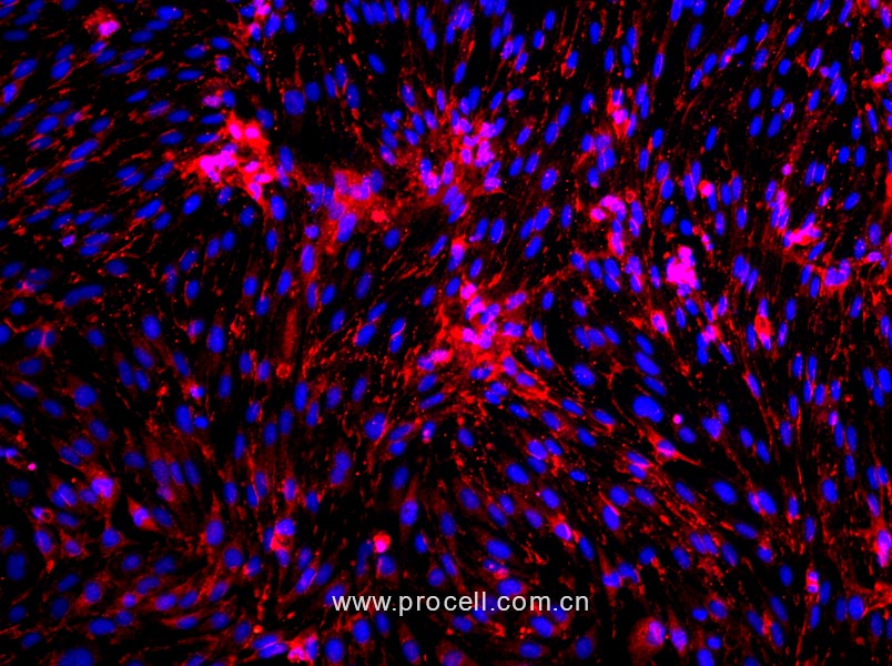 大鼠腦微血管內(nèi)皮細(xì)胞