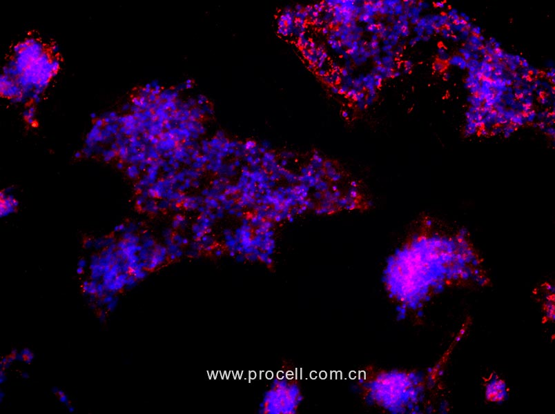 大鼠視網(wǎng)膜神經(jīng)節(jié)細胞