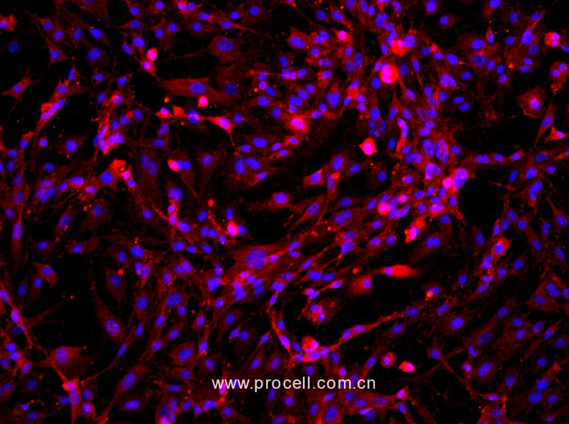 大鼠海綿體內皮細胞